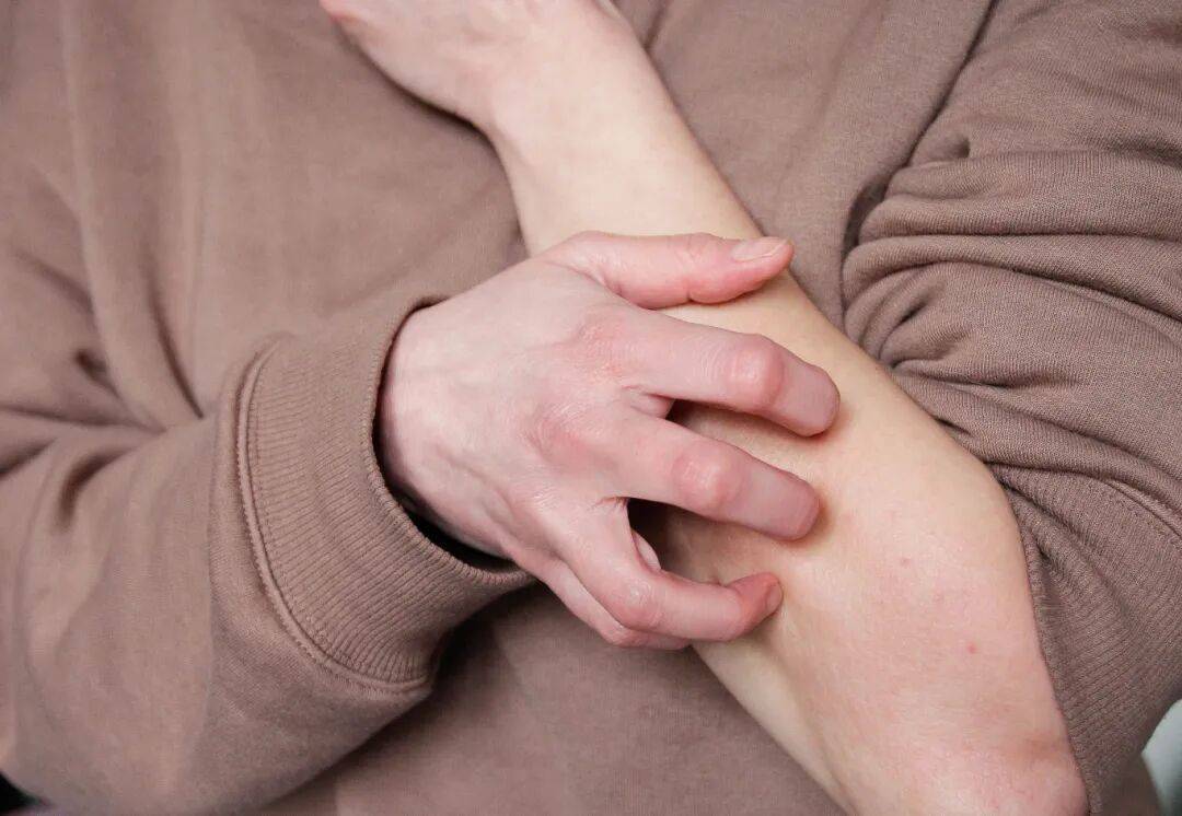 皇冠信用網开户_事发上海街头！女子突然浑身肿胀皇冠信用網开户，陷入昏迷...医生：建议随身携带肾上腺激素笔